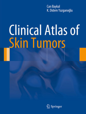 clinical atlas of skin tumors