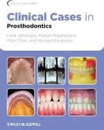clinical cases in prosthodontics