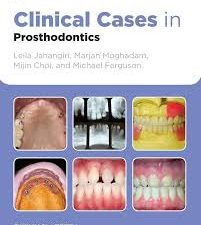 clinical cases in prosthodontics