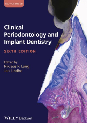 clinical periodontology and implant dentistry, 2 volume set, 6th edition