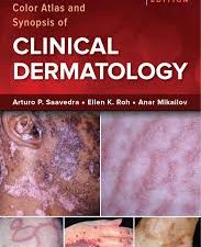 color atlas and synopsis of clinical dermatology