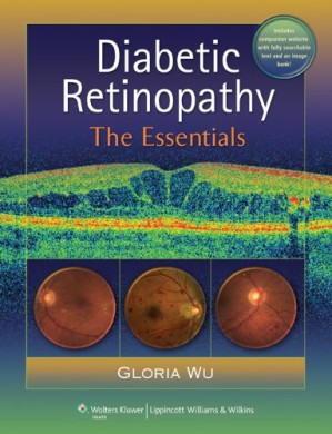 diabetic retinopathy: the essentials