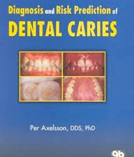 diagnosis and risk predication of dental caries