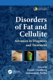 disorders of fat and cellulite