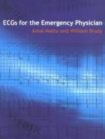 ecgs for the emergency physician