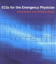 ecgs for the emergency physician