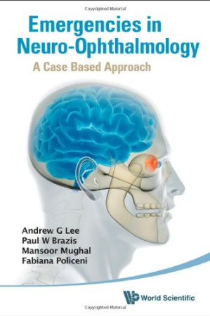 emergencies in neuro ophthalmology: a case based approach