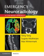 emergency neuroradiology: a case based approach