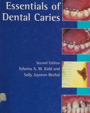 essentials of dental caries: the disease and its management