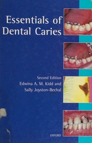 essentials of dental caries: the disease and its management