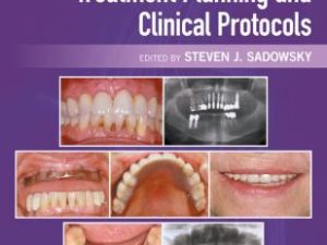 evidence based implant treatment planning and clinical protocols