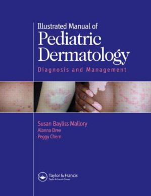 illustrated manual of pediatric dermatology: diagnosis and management