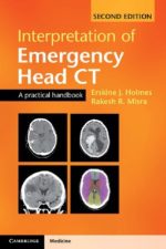 interpretation of emergency head ct: a practical handbook, second edition