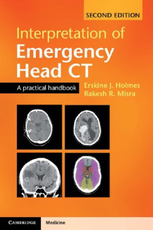 interpretation of emergency head ct: a practical handbook, second edition