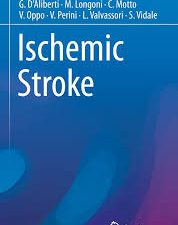 ischemic stroke (emergency management in neurology) 1st edition. 2017 edition