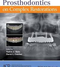 journal of prosthodontics on complex restorations