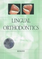 lingual orthodontics