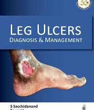management of leg ulcers