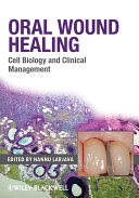 oral wound healing: cell biology and clinical management