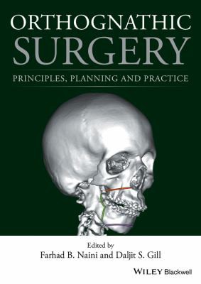 orthognathic surgery: principles, planning and practice
