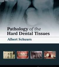 pathology of the hard dental tissues