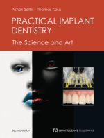 practical implant dentistry: the science and art, 2nd edition