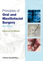 principles of oral and maxillofacial surgery (6th edition)