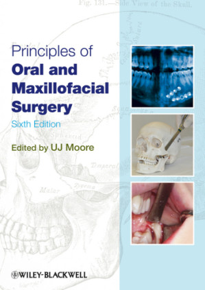 principles of oral and maxillofacial surgery (6th edition)