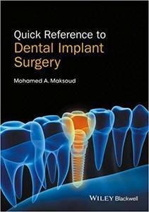 quick reference to dental implant surgery