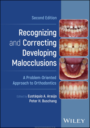 recognizing and correcting developing malocclusions: a problem oriented approach to orthodontics