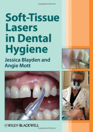 soft tissue lasers in dental hygiene