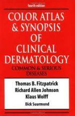 thomas b. fitzpatrick, richard a. johnson – color atlas and synopsis of clinical dermatology