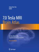 7.0 tesla mri brain atlas: in vivo atlas with cryomacrotome correlation