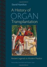 a history of organ transplantation: ancient legends to modern practice