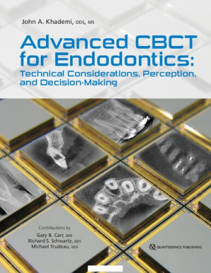 advanced cbct for endodontics: technical considerations,perception,and decision making