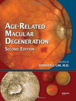 age related macular degeneration, second edition