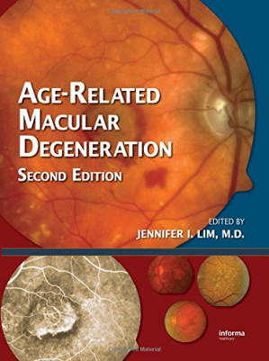 age related macular degeneration, second edition