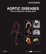 aortic diseases: clinical diagnostic imaging atlas