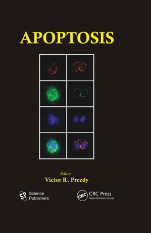 apoptosis: modern insights into disease from molecules to man