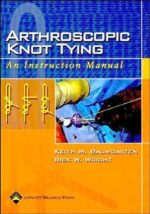 arthroscopic knot tying: an instruction manual