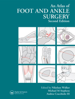 atlas foot and ankle surgery, 2nd edition