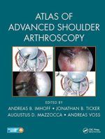 atlas of advanced shoulder arthroscopy