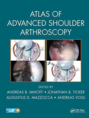 atlas of advanced shoulder arthroscopy