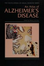 atlas of alzheimer’s disease
