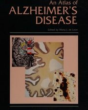 atlas of alzheimer’s disease