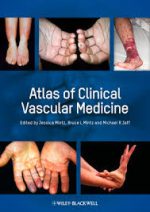atlas of clinical vascular medicine (2013)
