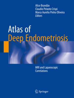 atlas of deep endometriosis: mri and laparoscopic correlations