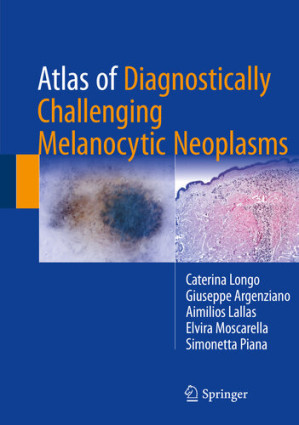atlas of diagnostically challenging melanocytic neoplasms