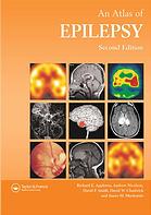 atlas of epilepsy (encyclopedia of visual medicine series) – 2nd edition