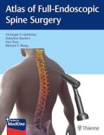 atlas of full endoscopic spine surgery